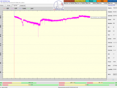 dxsatcs-eutelsat-21b-western-tpdw7-low-symbol-rate-radio-broadcasting-monitoring-11599-Chada FM Radio-Morocco-24h-snr-03