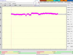 dxsatcs-eutelsat-21b-western-tpdw7-low-symbol-rate-radio-broadcasting-monitoring-11604.090-SNRT Dakhla radio-Morocco-24H-snr-03