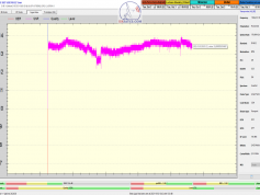 dxsatcs-eutelsat-21b-western-tpdw7-low-symbol-rate-radio-broadcasting-monitoring-11604.520-SNRT Oujda radio-Morocco-24h-snr-03