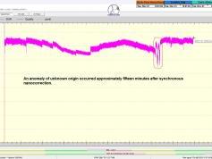 dxsatcs-eutelsat-5 west B-transalpine-dvb-s2-multistream-technology-reception-synchronous-nanocorrections-12626 H-SN03