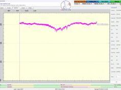 dxsatcs-eutelsat-5 west B-transalpine-dvb-s2-multistream-technology-reception-12648-mhz-v-Cplus-mux-france-SM-02