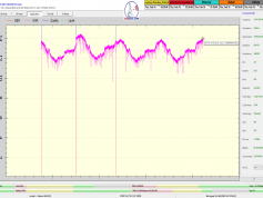 dxsatcs-eutelsat-9b-9e-italy-dvbs2-s2x-multistream-96h-signal-monitoring-12188-mhz-v-pf-370cm-E-01