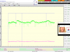 dxsatcs-eutelsat-9b-9e-italy-dvbs2-s2x-multistream-12188-mhz-v-signal-monitoring-E-01