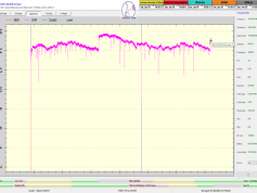 dxsatcs-eutelsat-9b-9e-italy-dvbs2-s2x-multistream-72h-snr-12188-mhz-v-synchronous-nanocorrections-in-action-F