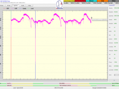 dxsatcs-eutelsat-9b-9e-italy-dvbs2-s2x-multistream-72h-snr-12380-mhz-v-synchronous-nanocorrections-by-author-roman-david-F