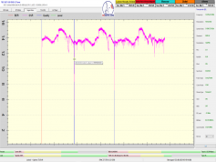 dxsatcs-eutelsat-9b-9e-italy-dvbs2-s2x-multistream-sat-reception-12380-mhz-v-anomaly-3-3-2023