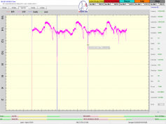 dxsatcs-eutelsat-9b-9e-italy-dvbs2-s2x-multistream-sat-reception-12380-mhz-v-anomaly-4-3-2023