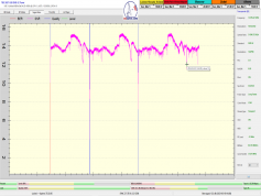 dxsatcs-eutelsat-9b-9e-italy-dvbs2-s2x-multistream-sat-reception-12380-mhz-v-anomaly-5-3-2023