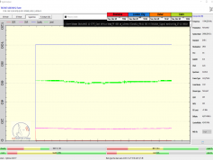 dxsatcs.com-nss-12-57-e-east-africa-beam-reception-11545 h-ethiosat-ethiopia-monitoring-f0-72h-step-02-