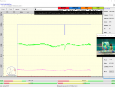 dxsatcs.com-nss-12-57-e-east-africa-beam-reception-11545 h-ethiosat-ethiopia-monitoring-f0-72h-step-04-