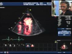 Insat 3A at 93.5 e _ feeds 4 053 V feeds from Kokilaben Hospital India  02