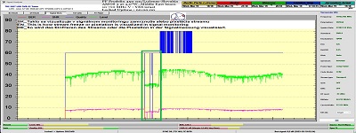 dxsatcs-amos-3-middle-east-sat-reception-prodelin-450cm-10722-mhz-v-Yes-israel-86H-monitoring-pixelation-freezing-vizualized-222-n