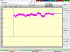 dxsatcs-ses 4-22-west-west-africa-footprint-canal-plus-afrique-sat-reception-11051-mhz-Synchronous-Nanocorrections-02