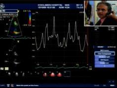 Insat 3A at 93.5 e _ feeds 4 053 V feeds from Kokilaben Hospital India  05
